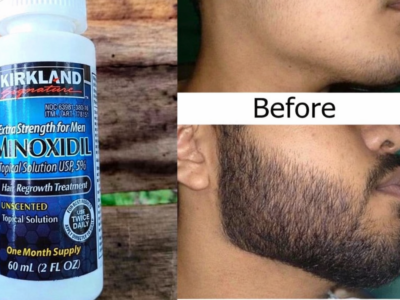 Minoxidil 5% Original – Barbe rapide et naturelle